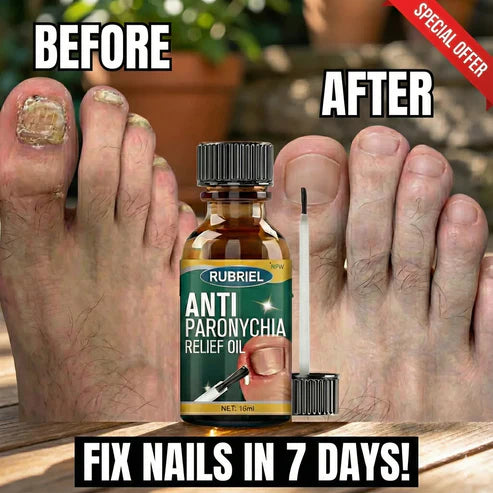 𝖭𝖺𝗂𝗅𝗌 𝖲𝗍𝗋𝗈𝗇𝗀 𝖦𝗋𝗈𝗐𝗍𝗁 𝖠𝗇𝖽 𝖱𝖾𝗉𝖺𝗂𝗋 𝖮𝗂𝗅 ( 𝖡𝖴𝖸 1 𝖦𝖤𝖳 1 𝖥𝖱𝖤𝖤 )