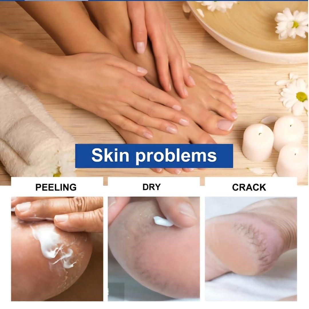 Feet Revive Cream    ( BUY 1 GET 1 FREE )
