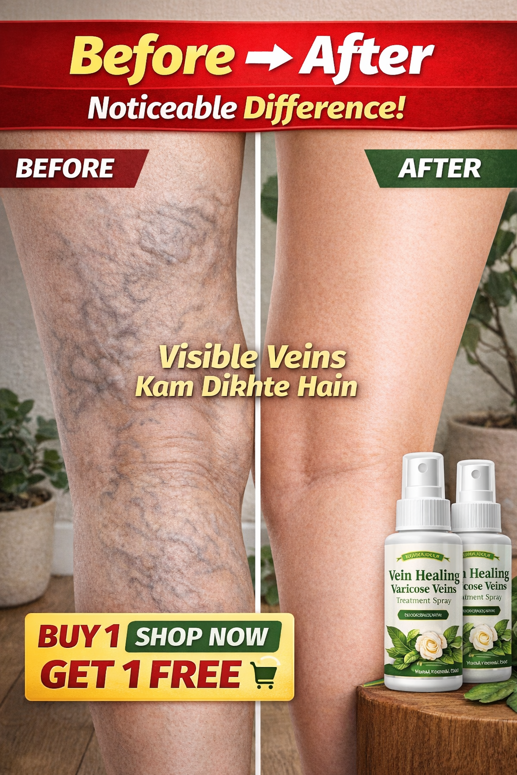 𝖵𝖾𝗂𝗇 𝖧𝖾𝖺𝗅𝗂𝗇𝗀 𝖵𝖺𝗋𝗂𝖼𝗈𝗌𝖾 𝖲𝗉𝗋𝖺𝗒 50𝗆𝗅 (𝖡𝖴𝖸 1 𝖦𝖤𝖳 1 𝖥𝖱𝖤𝖤 )